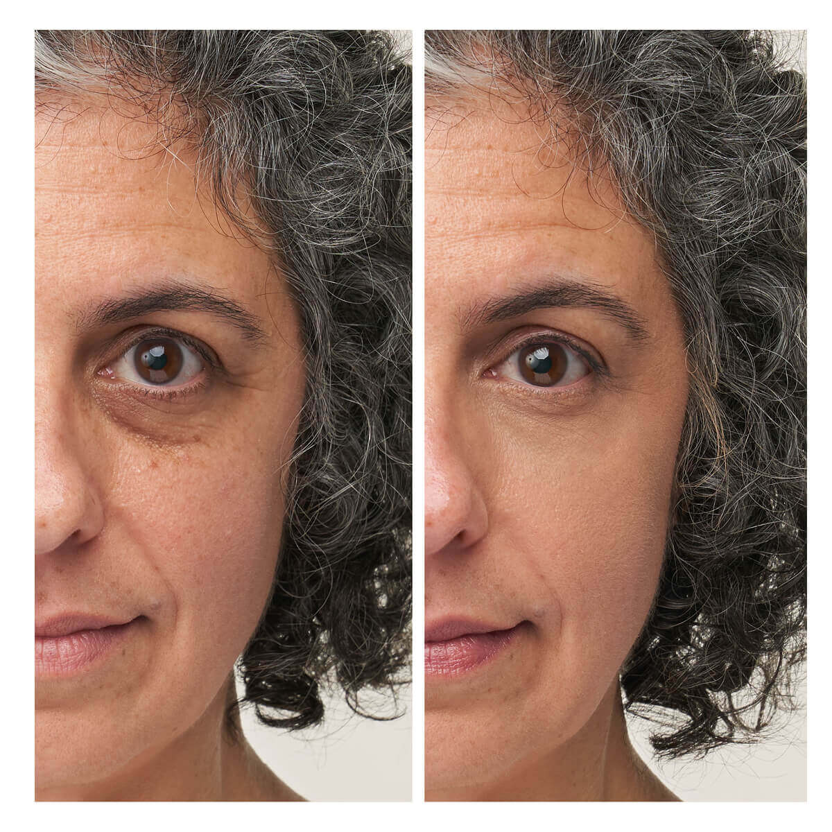 Enlighten Plus Under-Eye Concealer