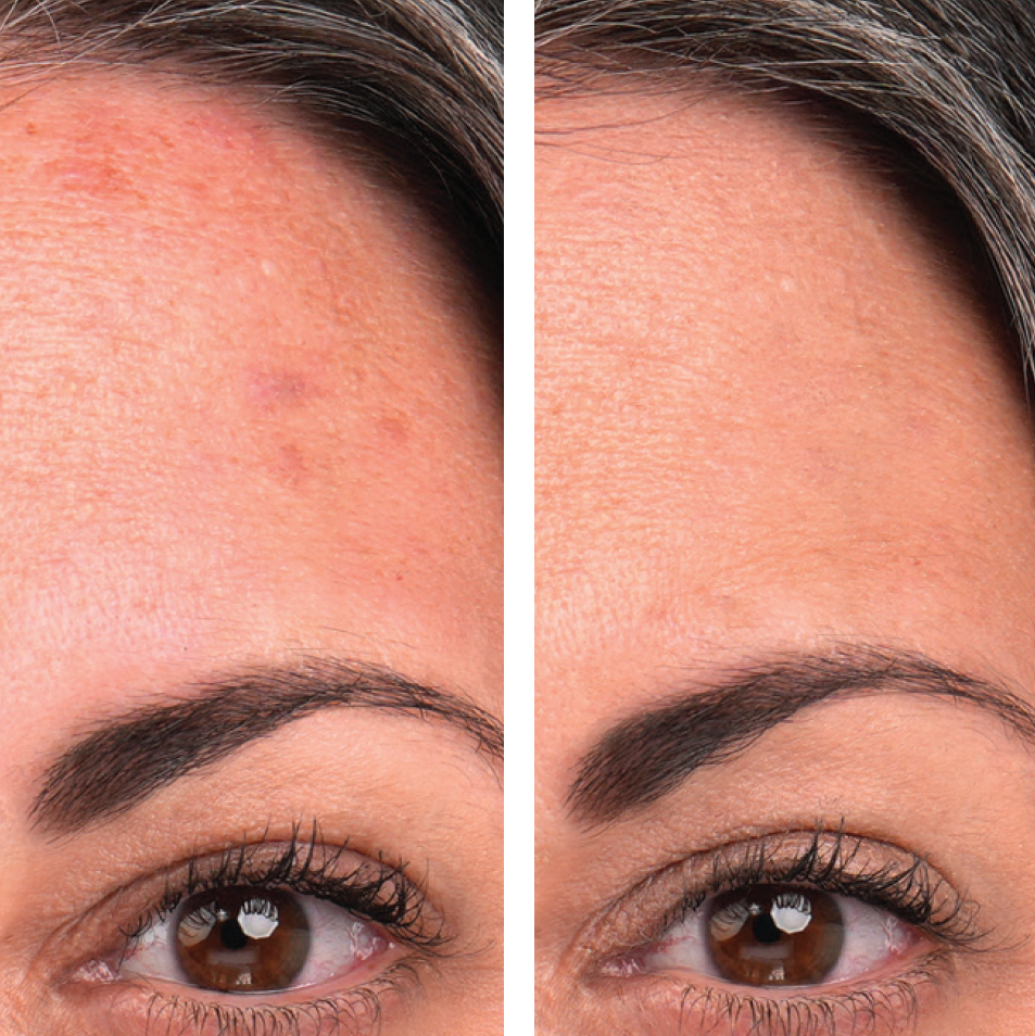 PureMatch Liquid Concealer