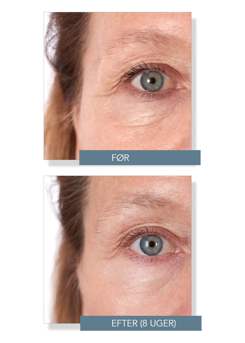 Hyaluronic Serum